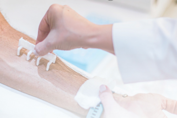 Médico alergista realizando prick test (teste  alérgico de leitura imediata) em consultório