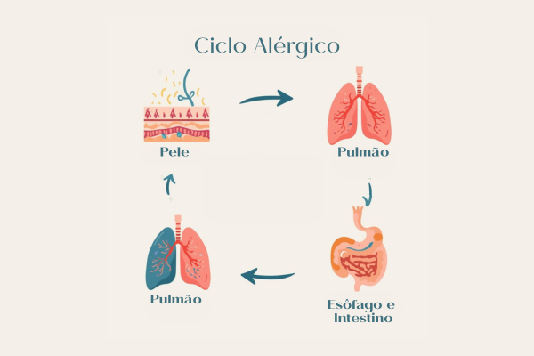 Ilustração mostrando a conexão entre pele, sistema respiratório e digestivo, representando a marcha alérgica.
