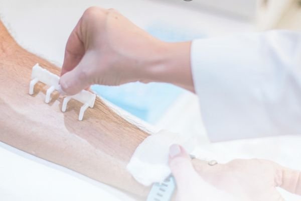 Médico alergista realizando prick test (teste  alérgico de leitura imediata) em consultório.
Imagem ilustrativa de consulta médica para diagnóstico da rinite alérgica, mostrando o especialista realizando o teste alérgico.
