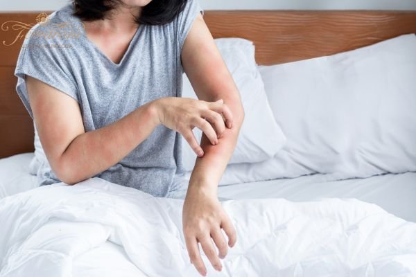 Pessoa apresentando sintomas de alergia a ácaros